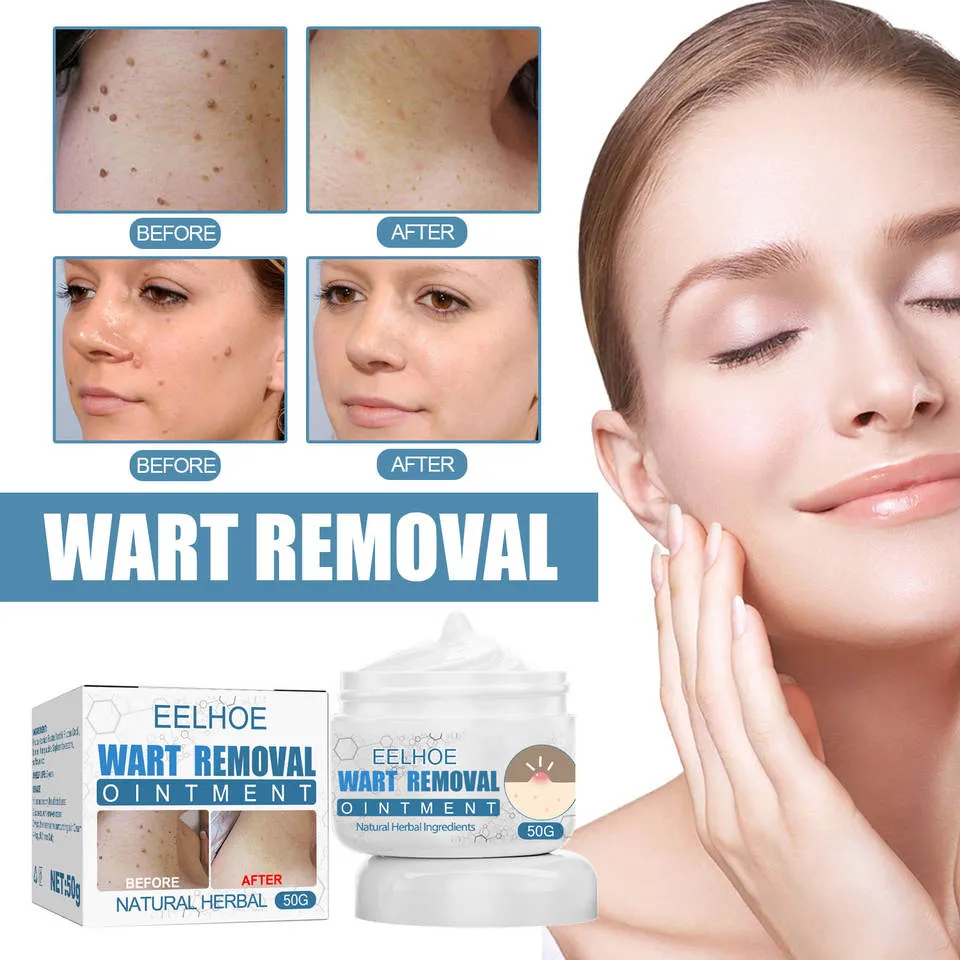 Skin Tag Remover Painless Mole Skin Dark Spot Moles Skin Tags Remover