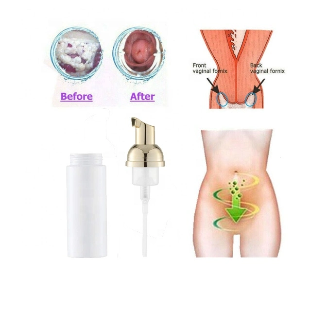 Hot Sale Feminine Wash Spray Foam pH Balance Hygiene Intimate Vaginal Cleaning