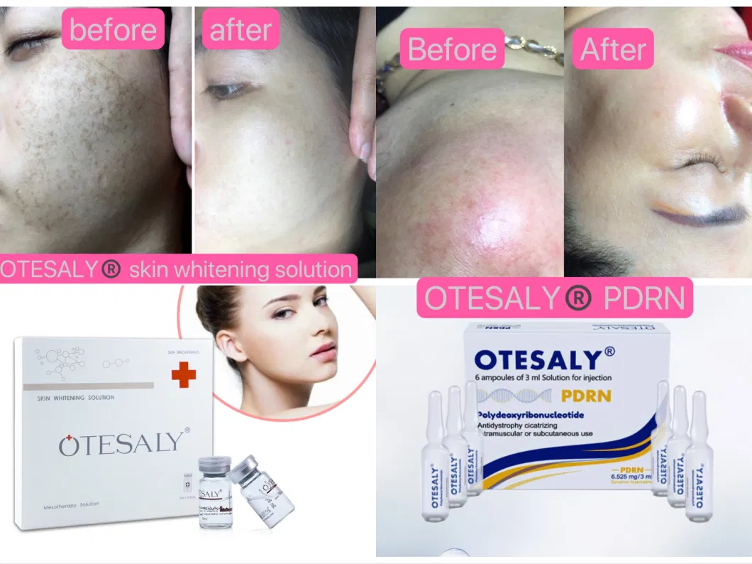 High Quality 5ml Whitening Beauty Plastic Therapy Otesaly Injection Whitening and Brightening Injection with Vitamin C