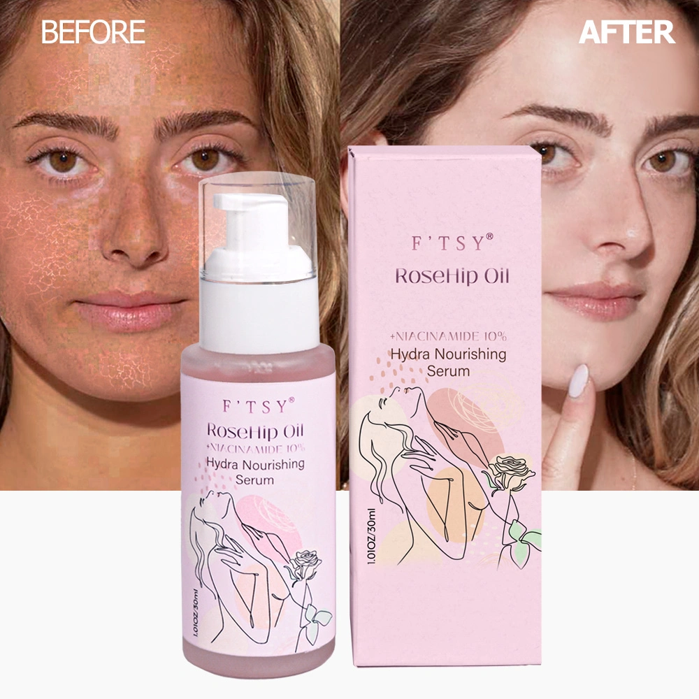 Hot Selling Natural Moisturizing Brightening Natural Extract Skin-Friendly Rose Hydrating Face Oil Facial Serum