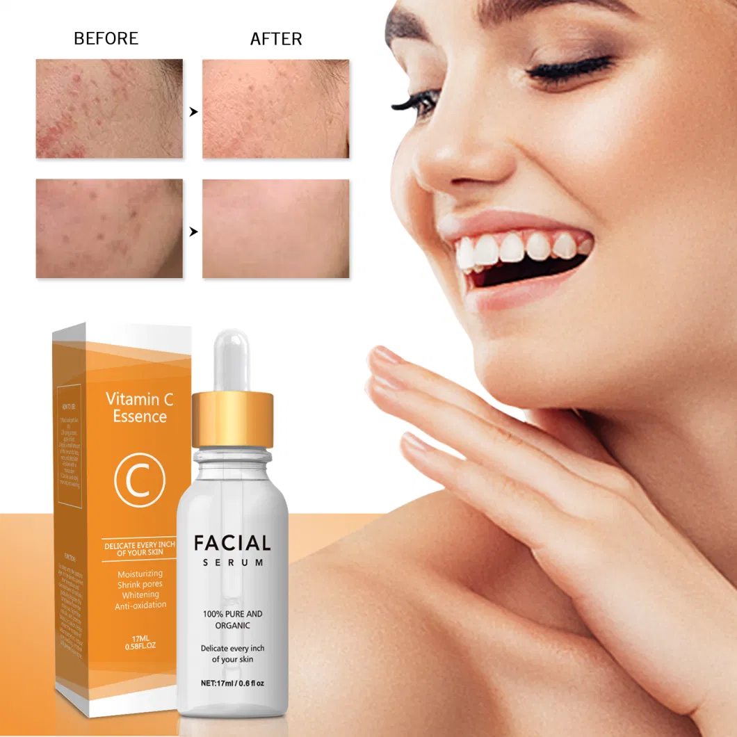 Private Label Facial Vitamin C with Anti Wrinkle Hyaluronic Acid Brightening Serum for Face