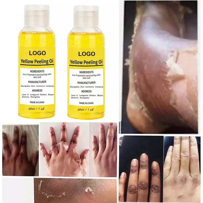 Body Hand Skin Cleansing Exfoliating Whitening Extra Strong Bleaching Dark Skin Private Label Yellow Peeling Oil