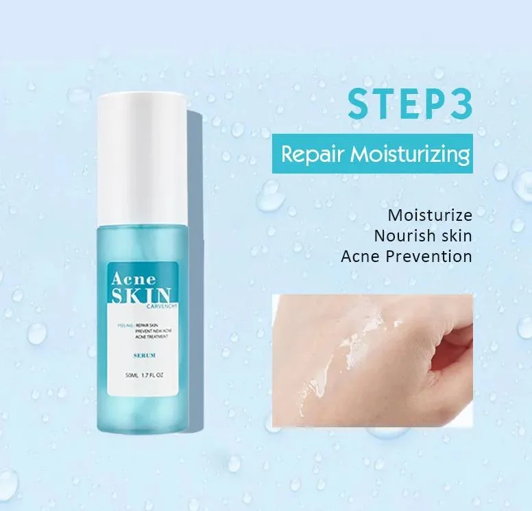 Online Wholesale in Stock Salicylic Acid Glycolic Face Cleanser Kit Serum Cream Remove Acne Scars Dark Spots Acne Treatment Skin Care Set