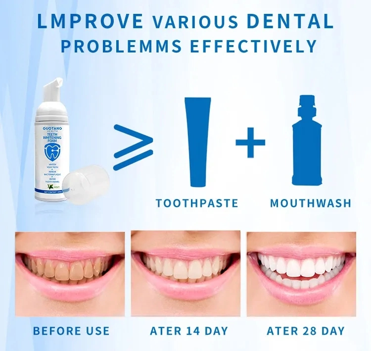 Toothpaste Tooth Mousse Cleaning Paste Private Logo Label Cleansing Teeth Whitening Foam