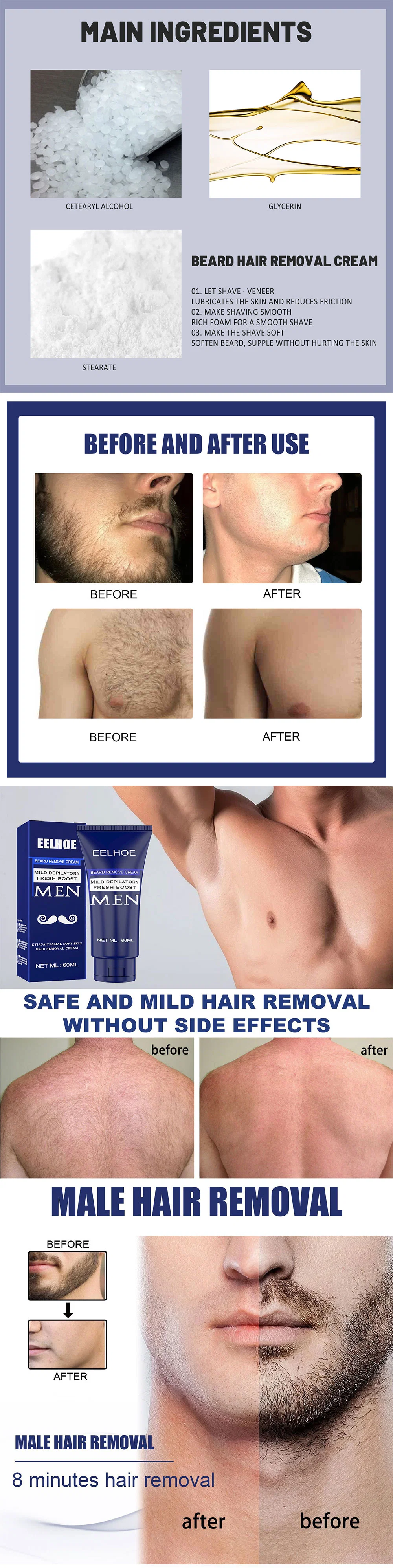 High Quality Fsat Men Beard Armpit Chest Body Fast Hair Removal Cream Gentle Hair Removal Delays Hair Growth