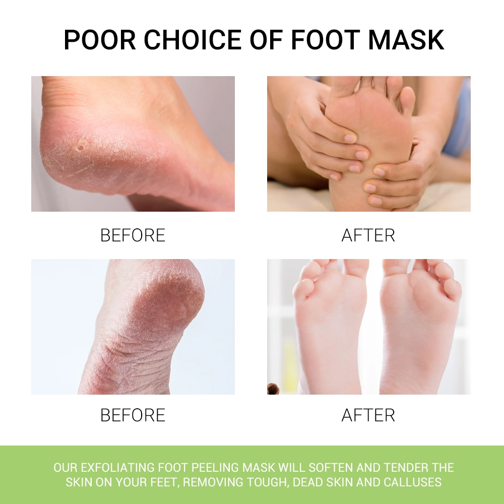 Manufacturer Price Aloe Vera Nourishing Moisturizing Skin Peeling Foot Sheet Mask &amp; Foot Peel Mask