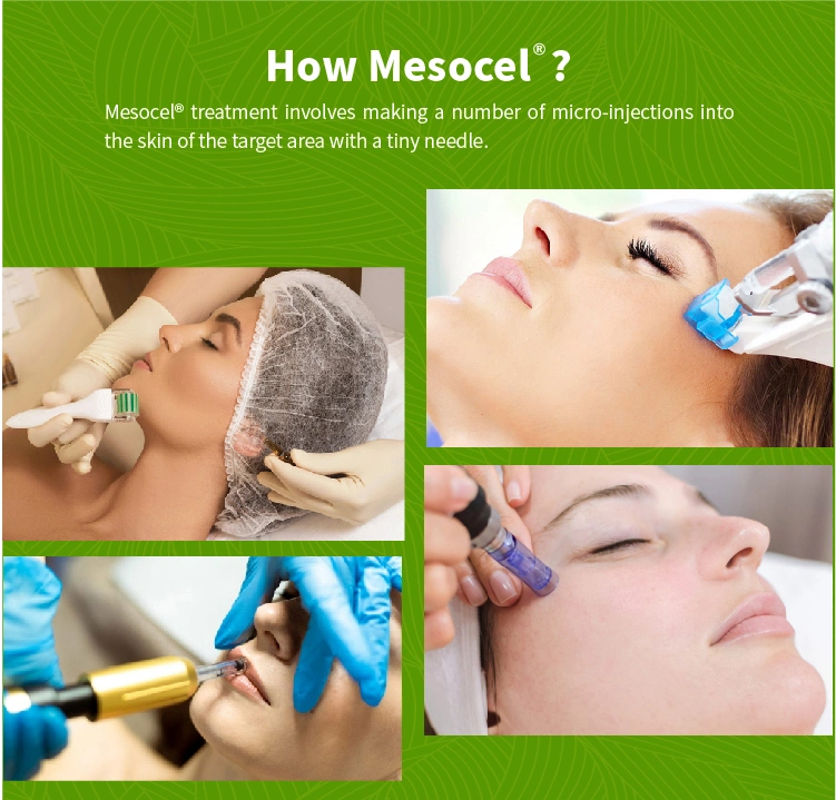 Mesocel Skin Moisturizing Hydration Face Seringues Hyaleron Acide Hyaluronique Ampoule Serum Pour