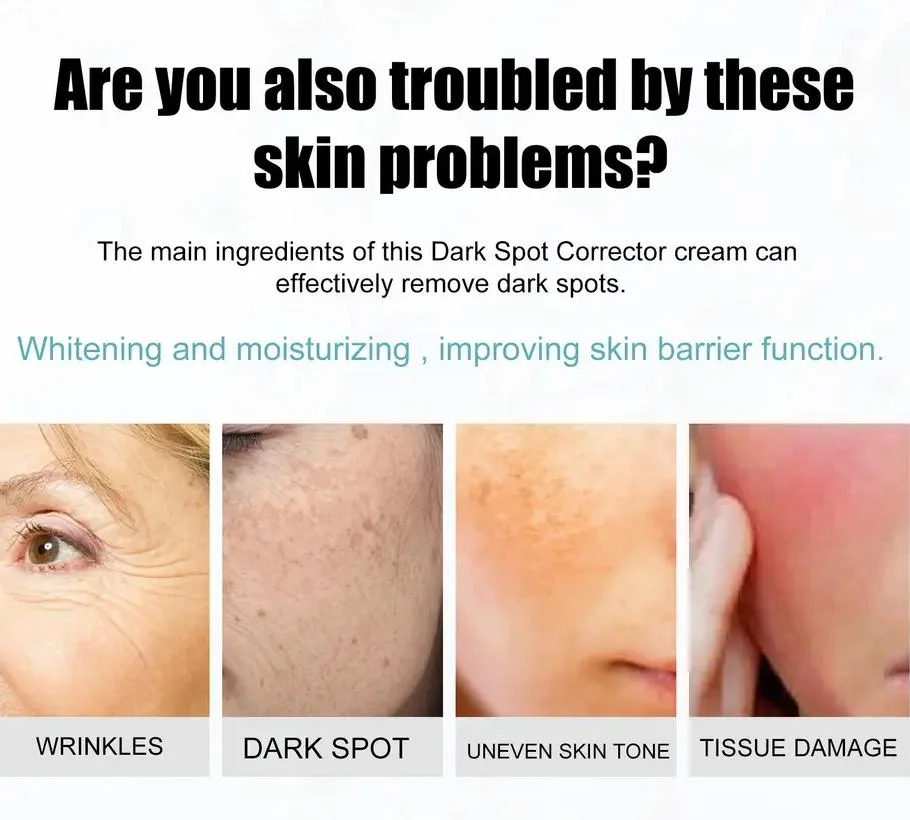 Collagen Cream Whitening Freckle Cream Melasma Remove Legs/Arms Face Dark Spot Corrector Cream