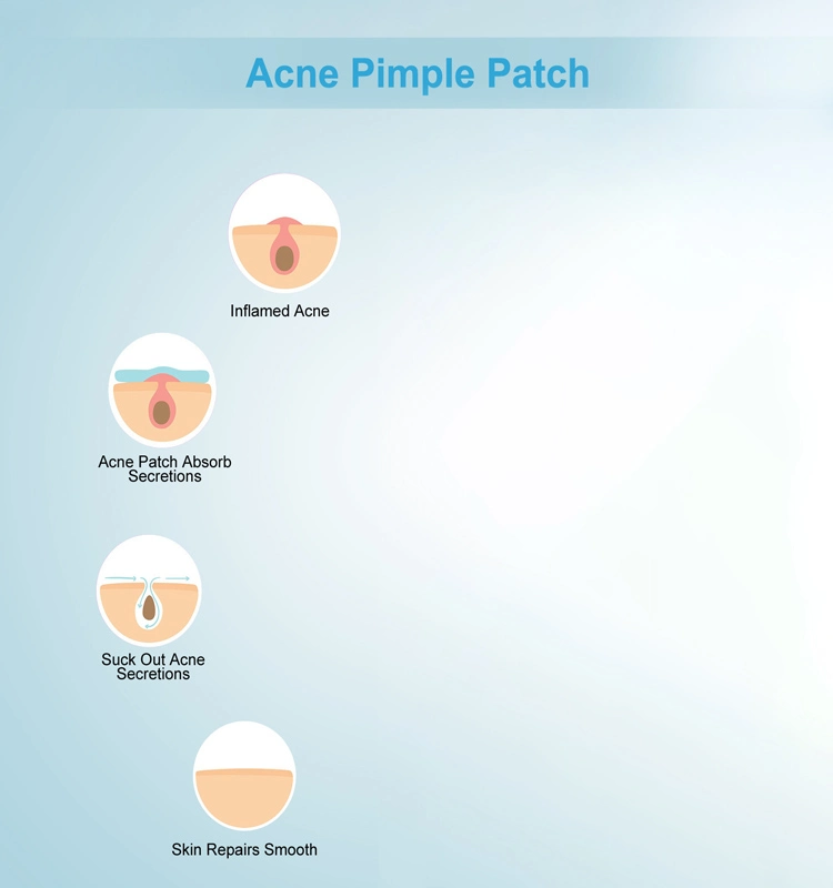 Spot Dots Treatment Acne Patches Private Label Waterproof Hydrocolloid Pimple Acne Patch with Salicylic Acid Skin Care