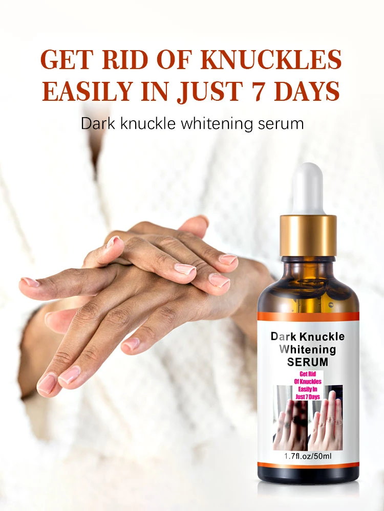 Mooyam Rapid Get Rid of Dark Hand Knuckle Whitening Serum Removing Dark Elbow Knees Clear Dark Knuckles Serum