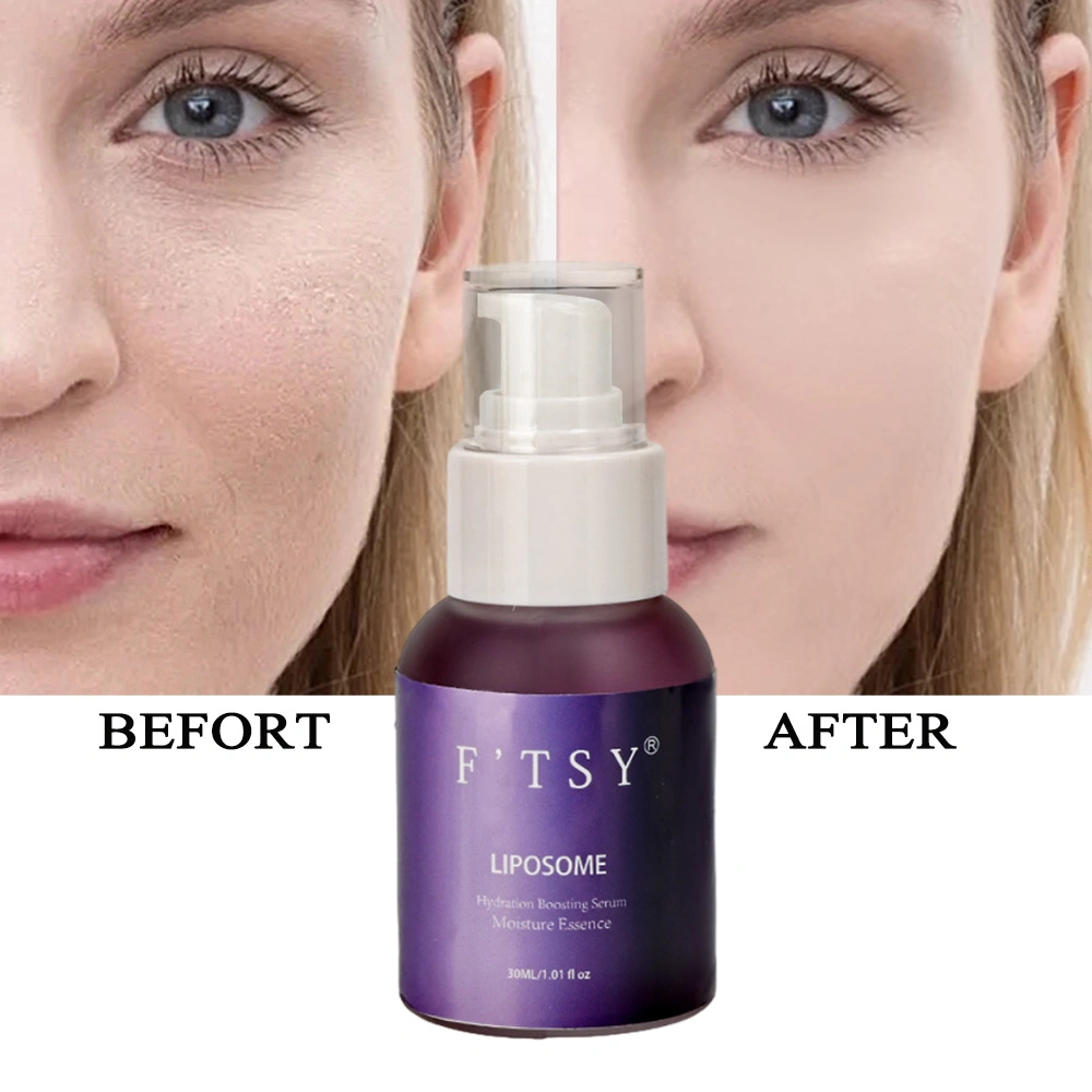 OEM/ODM Natural Whitening Liposome Serum with Vitamin C Hydration Anti-Aging Skin Care Essence