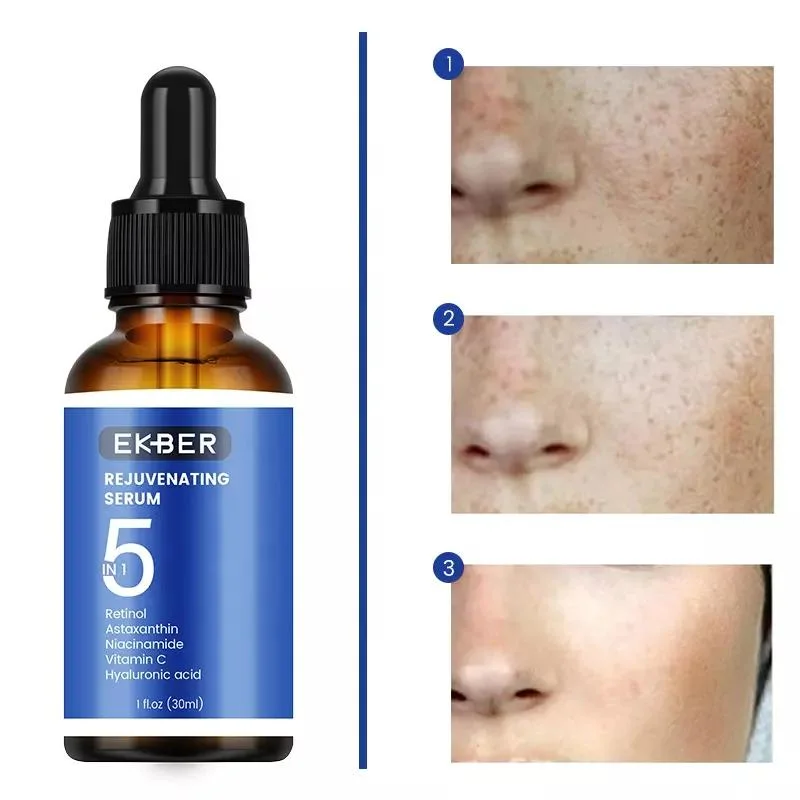 Ekber Private Label Skin Brightening Whitening 5 in 1 Powerful Removing Dry Lines Fine Lines Dullness Repair Acne Spots Dark Circles Anti Aging Face Serum