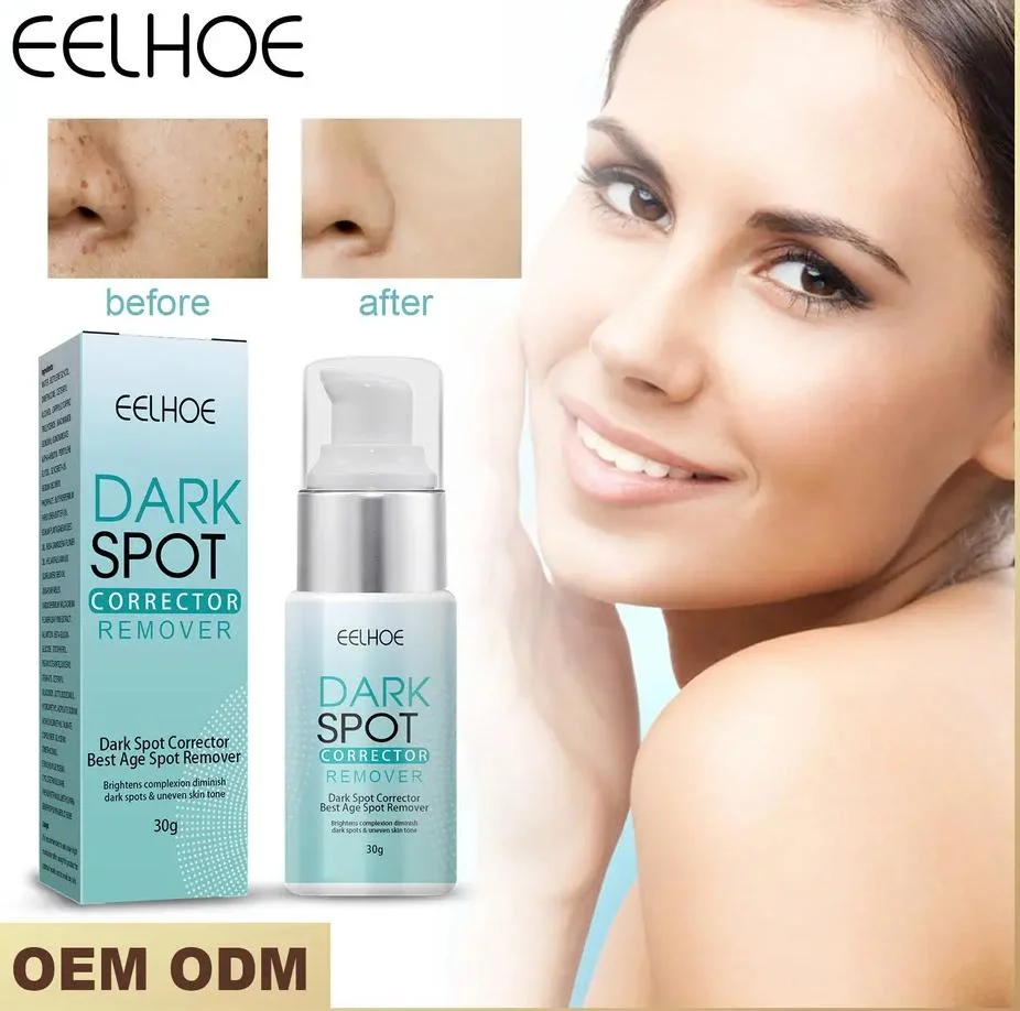 Collagen Cream Whitening Freckle Cream Melasma Remove Legs/Arms Face Dark Spot Corrector Cream