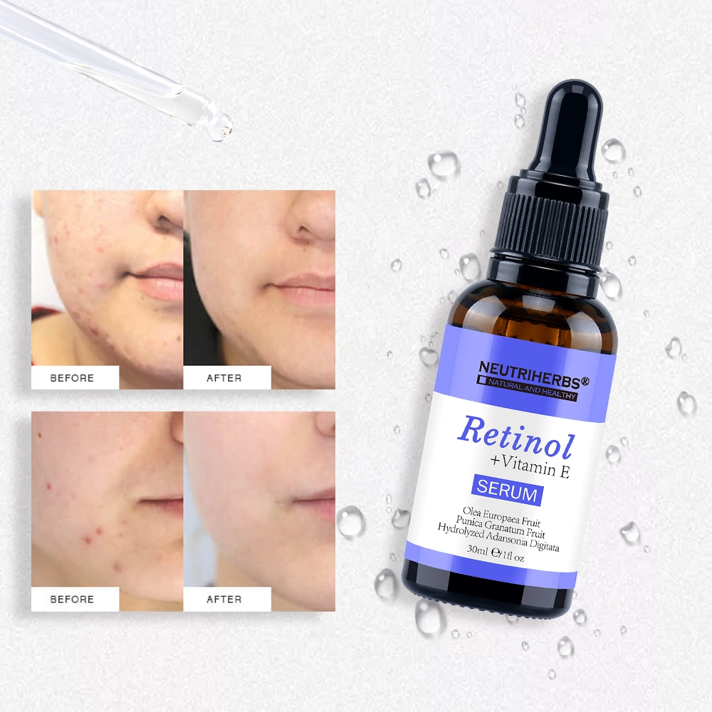 Neutriherbs New Beauty Product Skin Care Anti Aging Brightening Retinol Serum