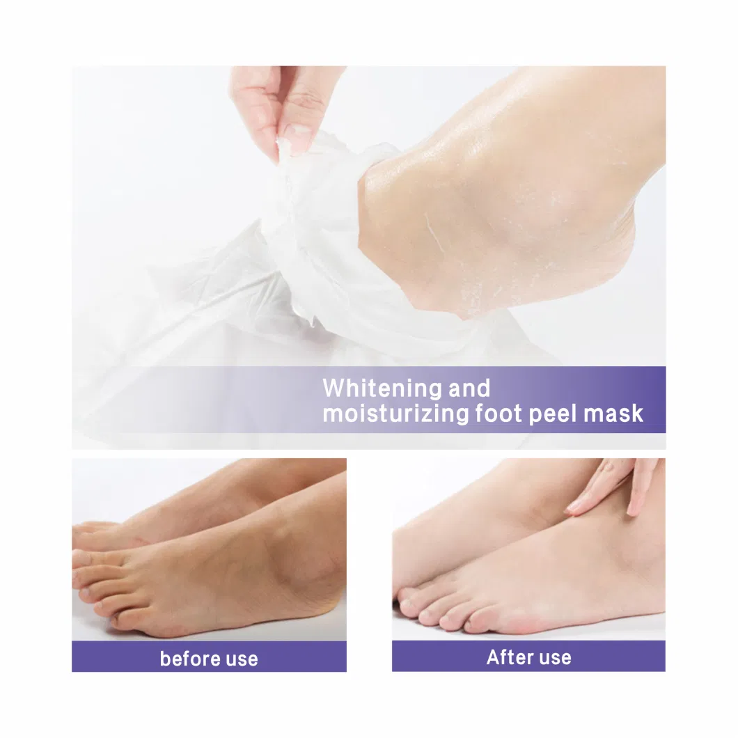 Manufacturer Price Aloe Vera Nourishing Moisturizing Skin Peeling Foot Sheet Mask &amp; Foot Peel Mask