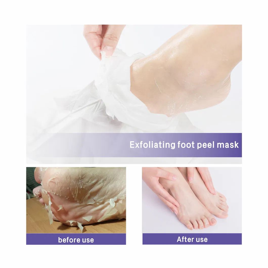 Manufacturer Price Aloe Vera Nourishing Moisturizing Skin Peeling Foot Sheet Mask &amp; Foot Peel Mask