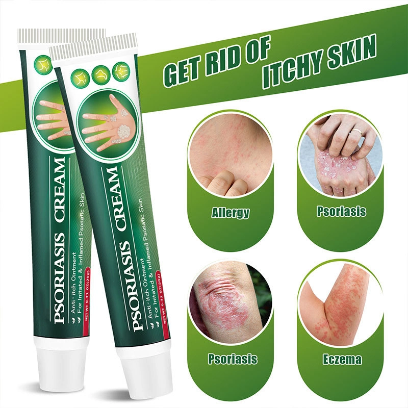 Hot Selling Fungal Infection Skin Psoriasis Creams Dermatitis Eczema Ointment Treatment Psoriasis Cream Skin Cream