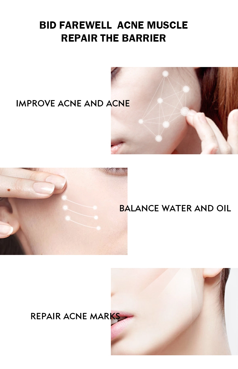 Balancing Acne Control and Skin Lightening Toner with Tea Tree Spray