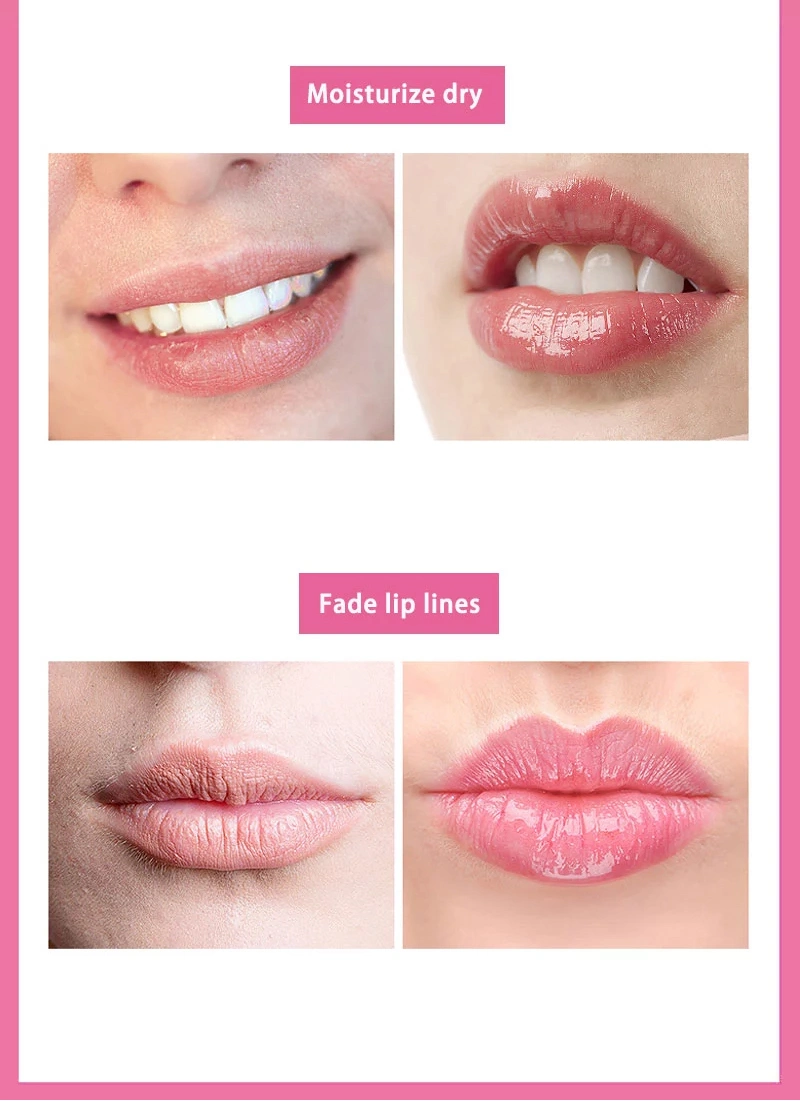 2020 Hot Selling Wholesale Natural Acid Vitamin E Hydrogel Collagen Lip Mask