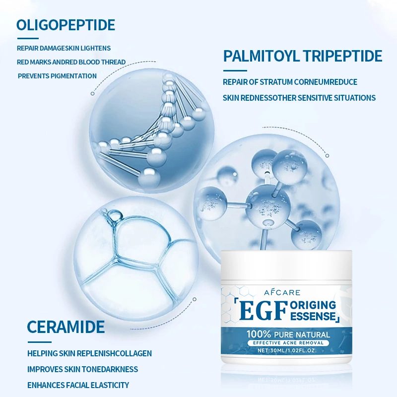 EGF 100% Natural Dispel Acne Cream Moisturize and Fade Acne Scars Essence