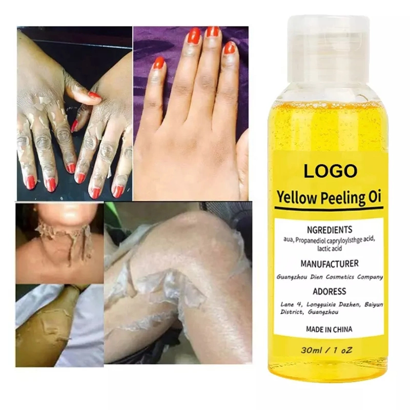 Body Hand Skin Cleansing Exfoliating Whitening Extra Strong Bleaching Dark Skin Private Label Yellow Peeling Oil