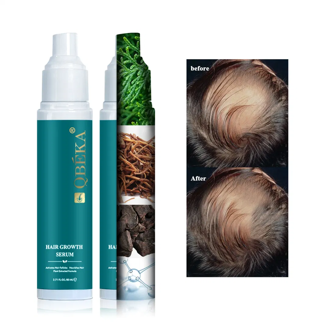 Hair Loss &amp; Thinning Treatments Hair Care Spray Best Quality 15 Days Effect Hair Growth Serums