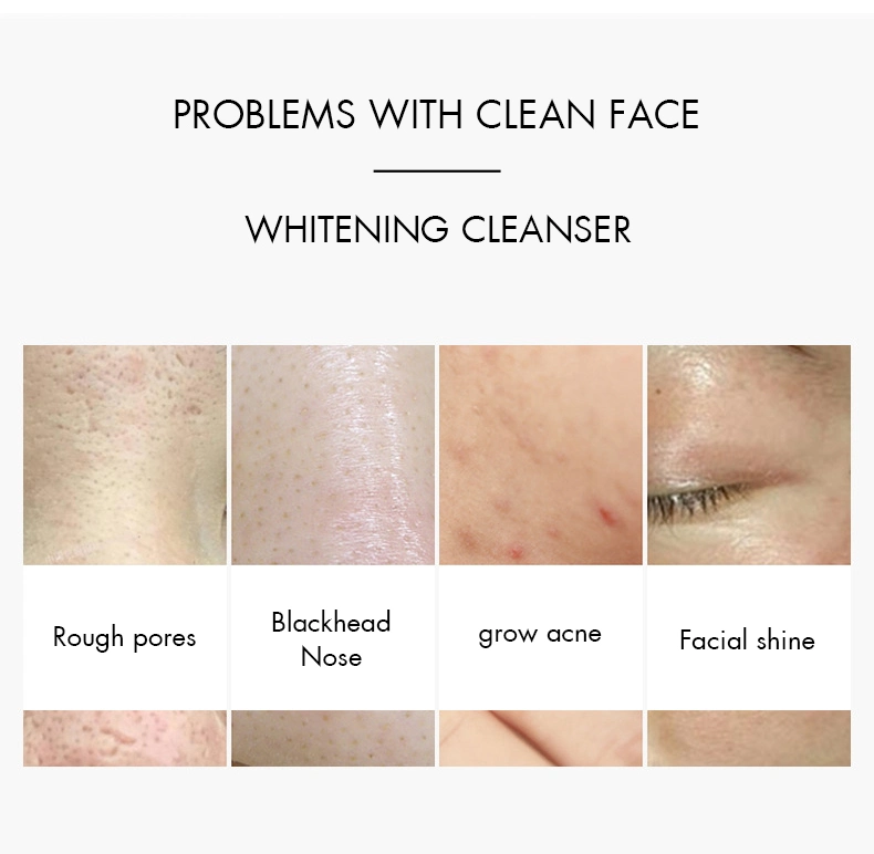 Amino Acid Mild Private Label Cleansing Foam Vc Whitening Cleansing Cleanser