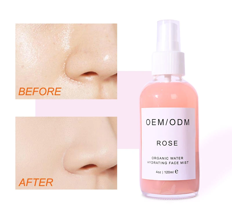 Beauty Cosmetics Skin Care Anti Acne Rose Water Toner Face Mist Spray