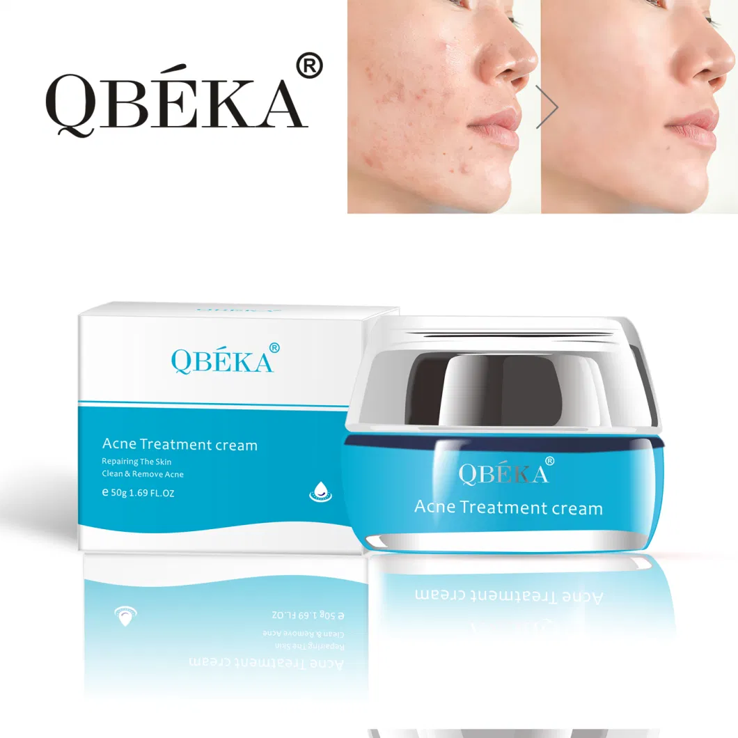 High Effect Qbeka Acne Treatment Cream Professional Cleansing Pimples Essence Cream Hamamelis Virginiana Acne Scar Removal Aloe Vera Face Cream