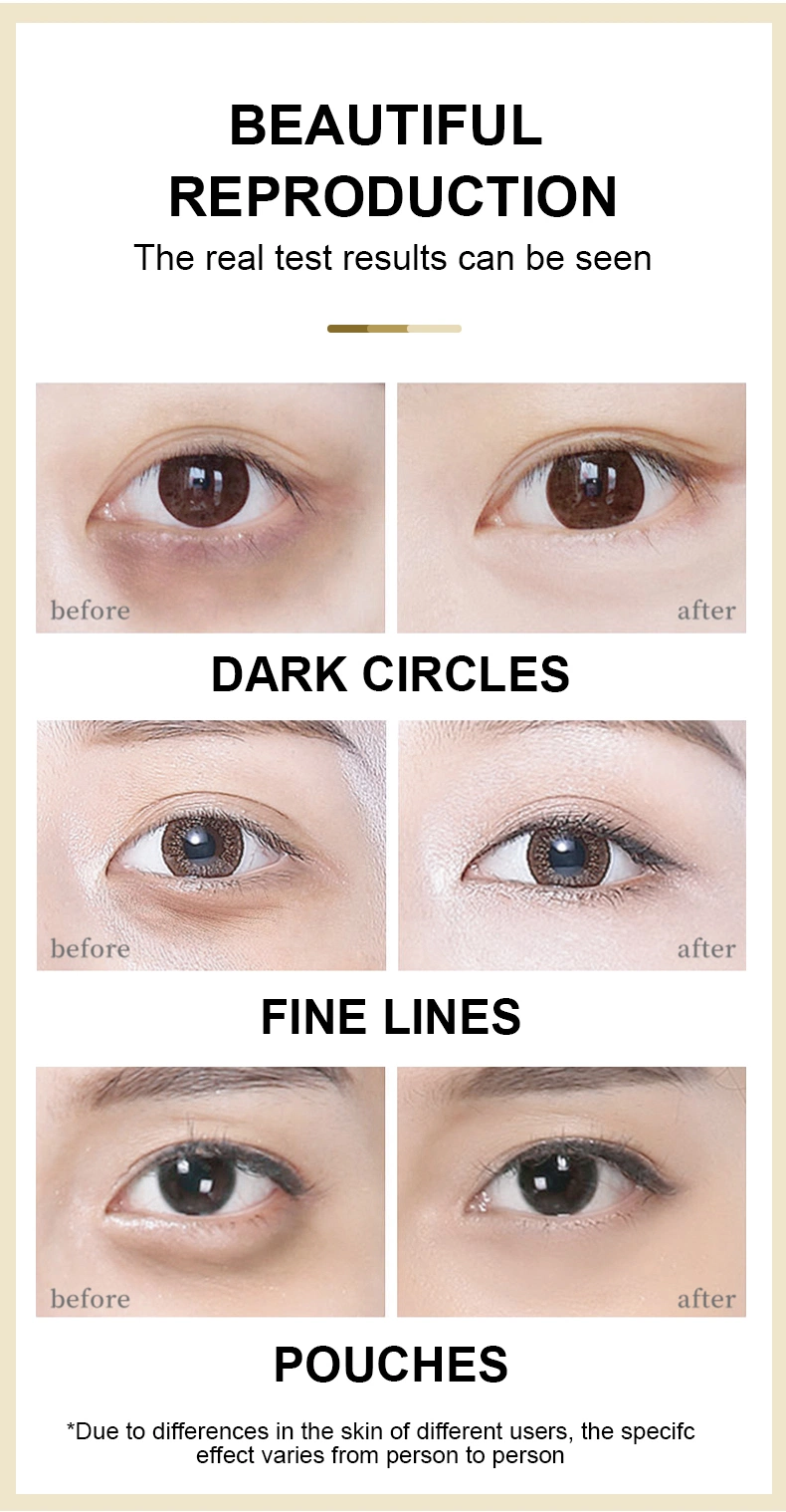 Remove Dark Circle Anti-Wrinkle Organic Moisturizing Collagen Golden Hydrogel Eye Mask