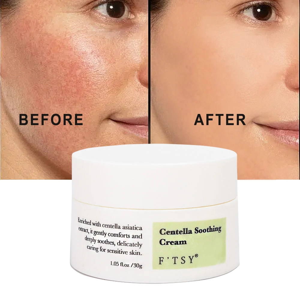 High Quality Repairing Moisturizing Spot Lightening Marine Algae Squalane Skin Care Face Centella Asiatica Cream Moisturizer