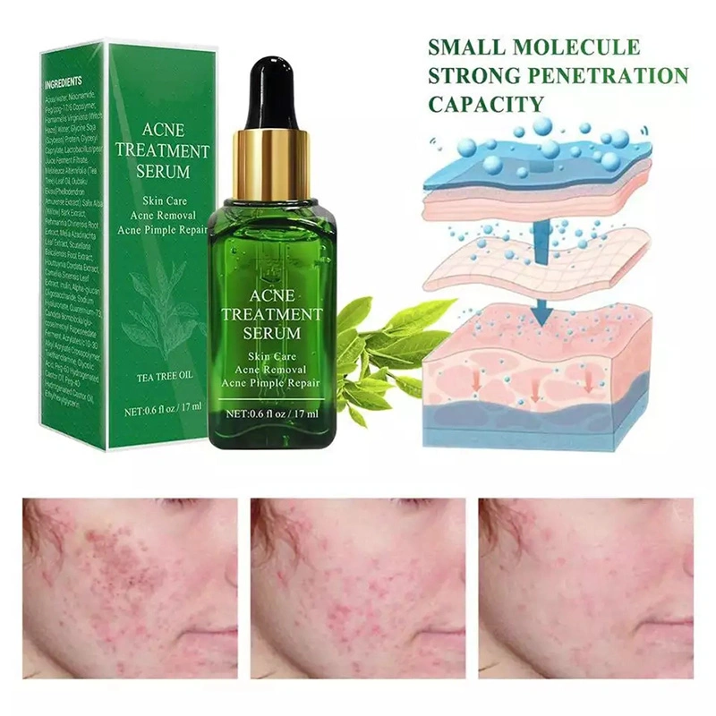 Facial Skin Care Essence Vitamin C Acne Dark Spot Remover Anti Wrinkle Brightening Whitening 24K Gold Rose Serum for Face