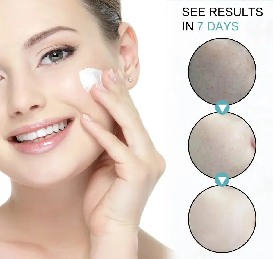 Collagen Cream Whitening Freckle Cream Melasma Remove Legs/Arms Face Dark Spot Corrector Cream