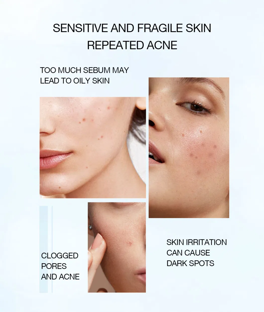 Acne High Quality Amino Acid Salicylic Face Wash Skin Cleanser