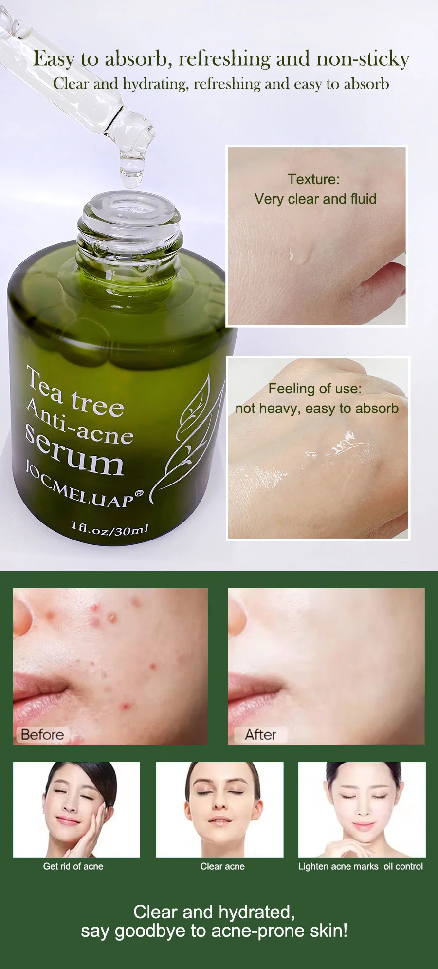 Private Label Skin Care Organic Tea Tree Hydrating Anti Acne Serum Facial Serum for Dark Spot Acne