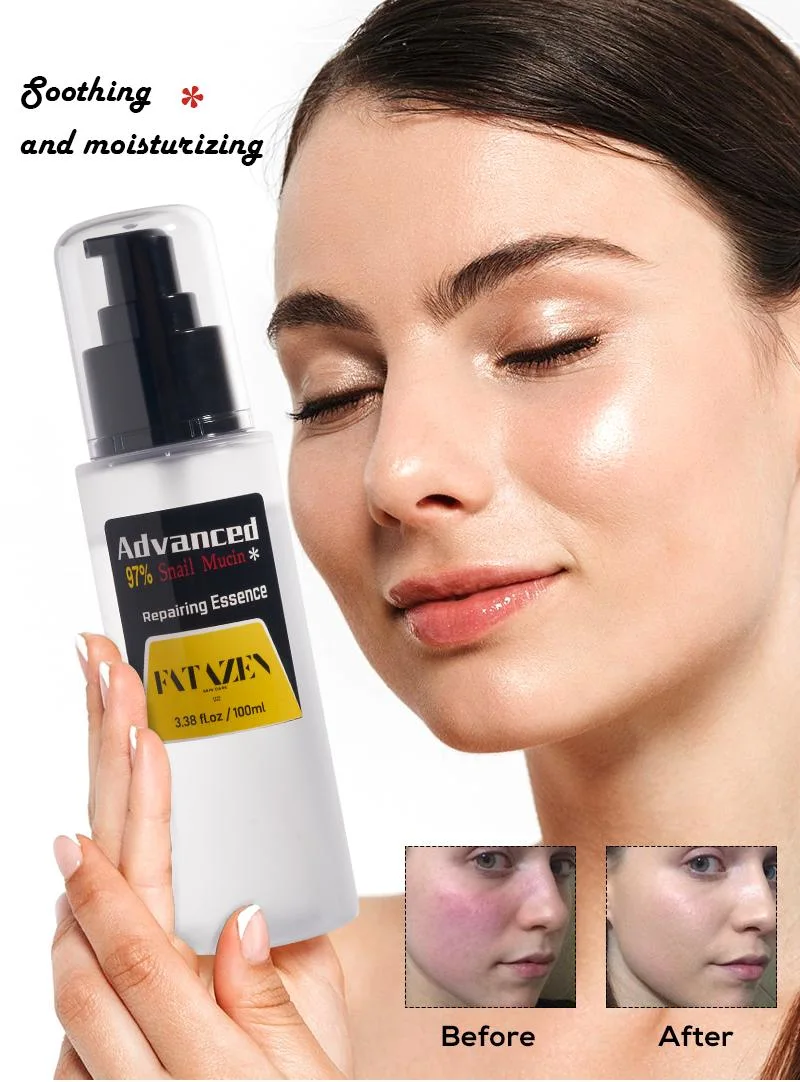 Wholesale Anti-Age Dark Spot Removal Repairing Moisturizing Serum Private Label Skin Care Products Anti Acne Snail Facial Serum