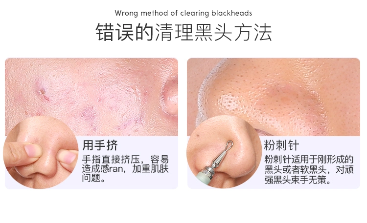 Removing Blackhead Acne, Fine Shrinking Pore Repair Gel Acne Removing Cream