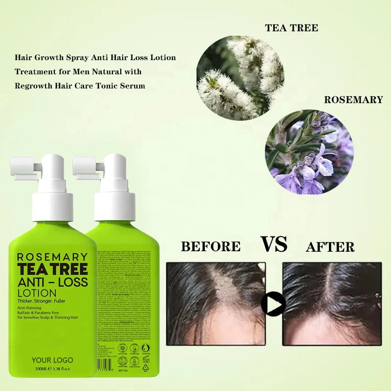 Anti Hair Loss Treatment Growth Serum Rosemary Tea Tree Energy Hair Tonic