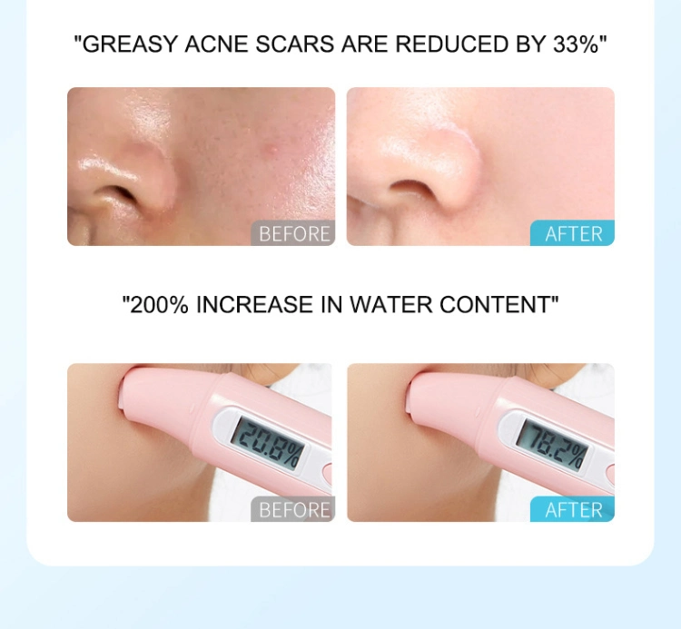Skin Care Cleansing Shrinking Pores Oil Control Salicylic Acid Ice Cream Face Mask Anti Acne Hydrating Repairing Sleeping Gel Facial Mask