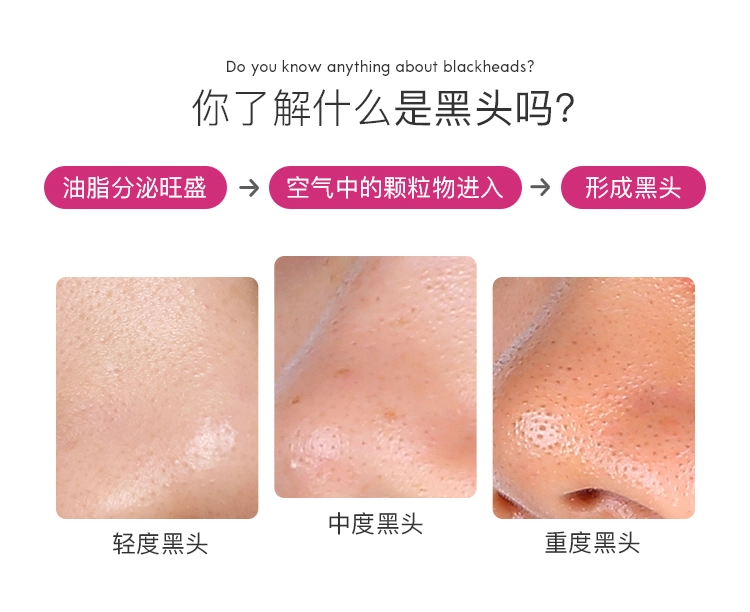 Removing Blackhead Acne, Fine Shrinking Pore Repair Gel Acne Removing Cream