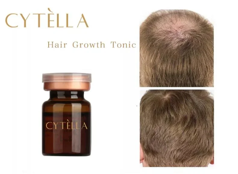 Wholesale Professional Hair Products Hair Growth Tonic