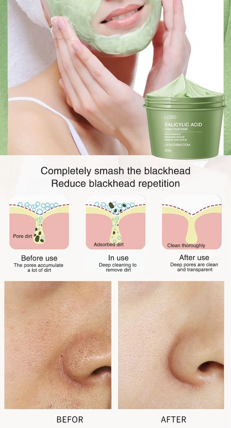 Deep Cleansing Acne Pore Blackhead Face Oil Control Green Tea Mud Clay Mask