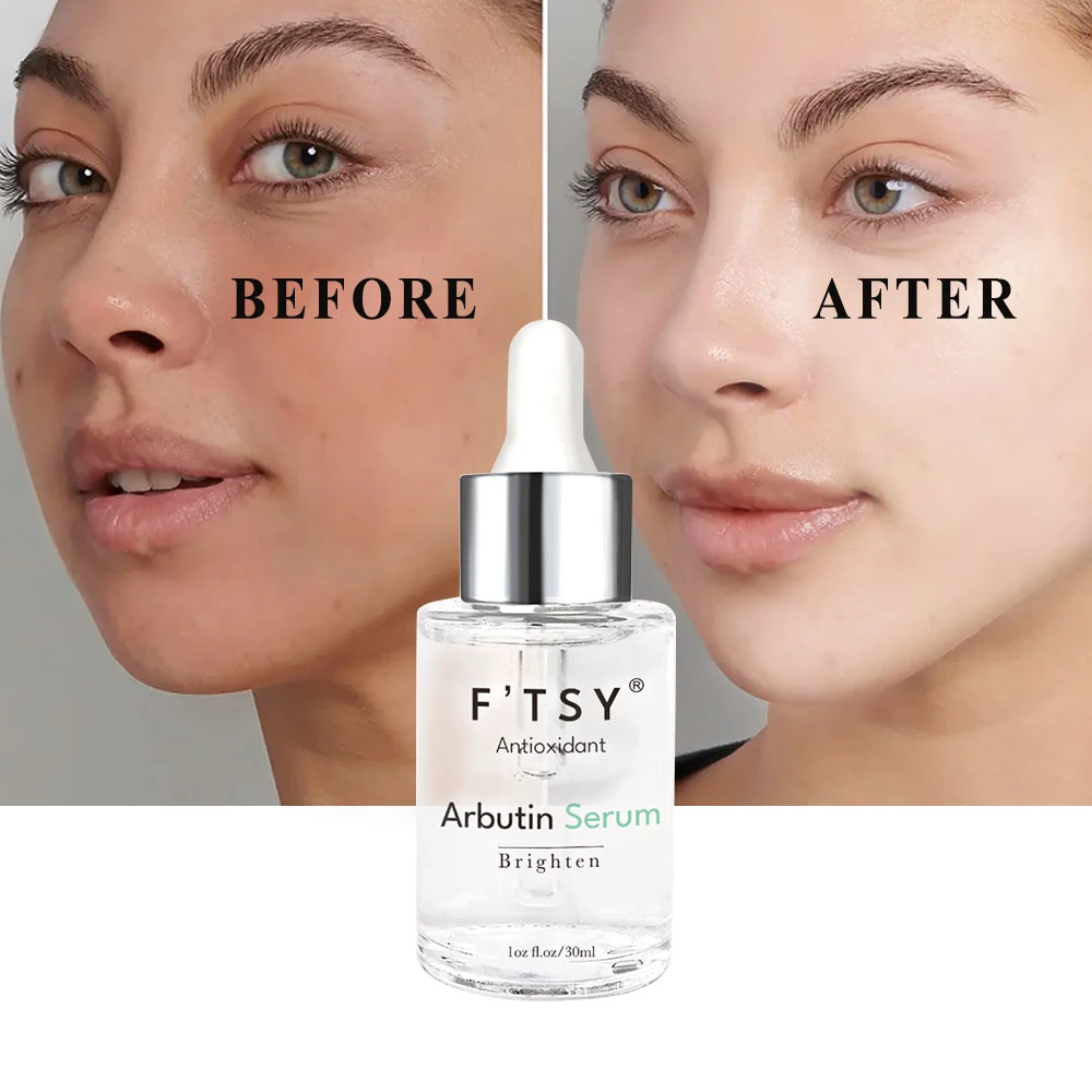 Factory Price Natural Whitening Kojic Acid Serum with Arbutin Even Skin Tone Lightening Niacinamide Facial Essence