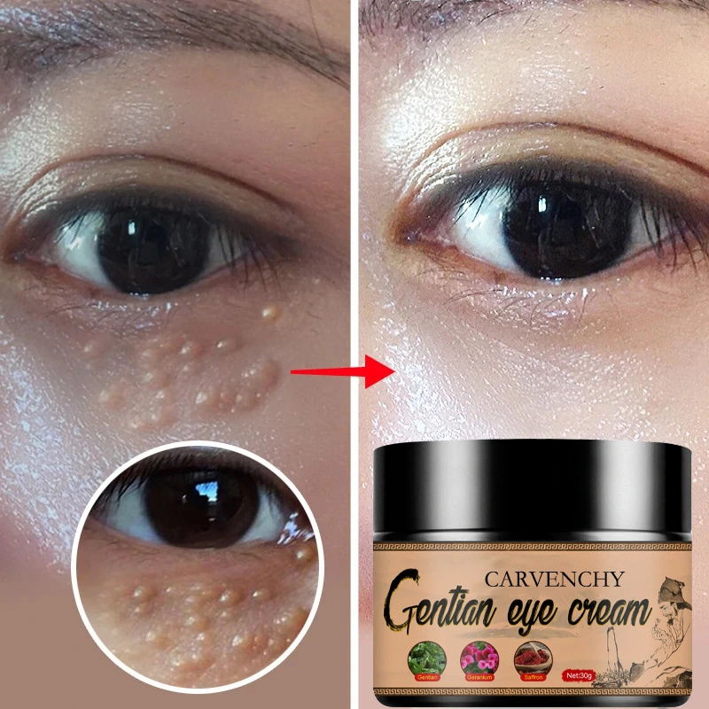 Wrinkle and Wrinkle Removing Eye Bag Elastic Moisturizing Firming Eye Cream