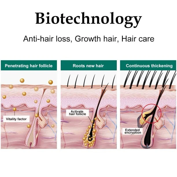 Anti-Hair Loss Follicle Nourish Hair to Protect Hair Growth Tonic