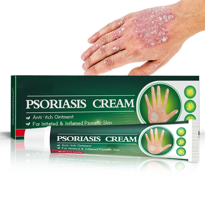 Hot Selling Fungal Infection Skin Psoriasis Creams Dermatitis Eczema Ointment Treatment Psoriasis Cream Skin Cream