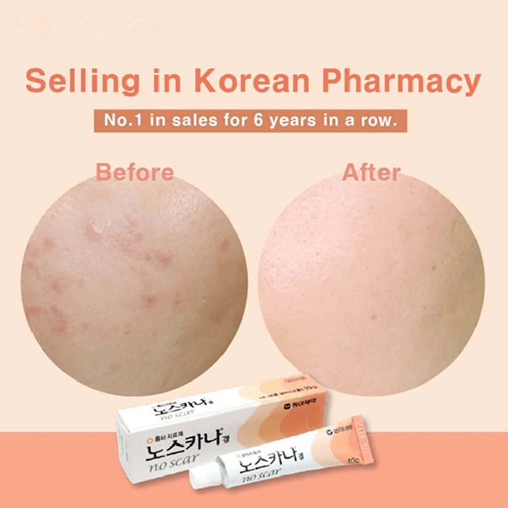 Noscarna Scar Removing Cream 20g Removing Acne Marks