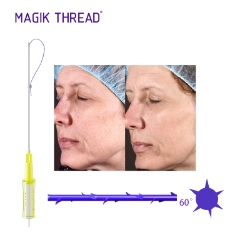 Mesocel Private Label Skin Booster Serum Injectable Mesotherapy with Microneedling to Anti-Aging