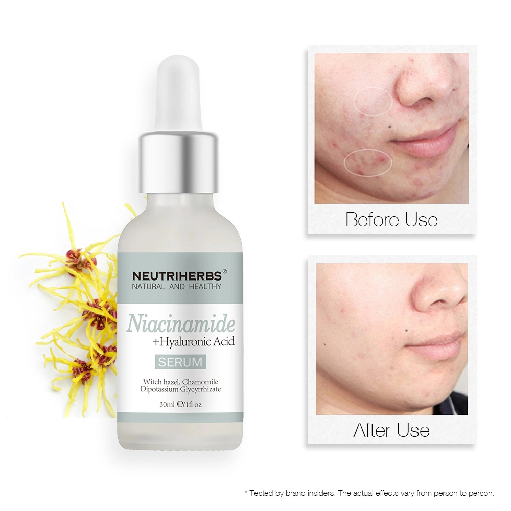 Skin Facial Care 30ml Moisturizing Purifying Restoring Hydrating Face Serum Niacinamide Serum