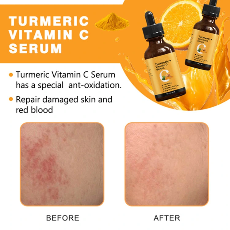 100% Natural Organic Turmeric+Vitamin C Serum for Anti Acne Anti Aging